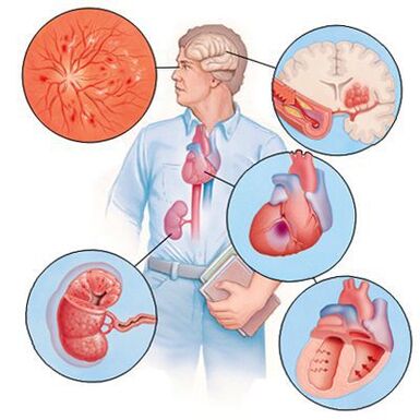 Cardiol sprječava razvoj popratnih bolesti